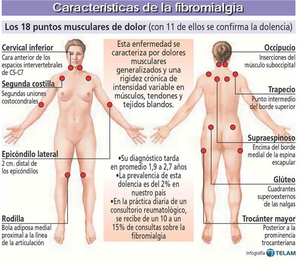 fibromialgia1